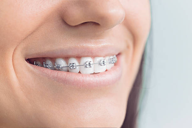 Best Invisalign and Clear Aligners  in Pottsboro, TX